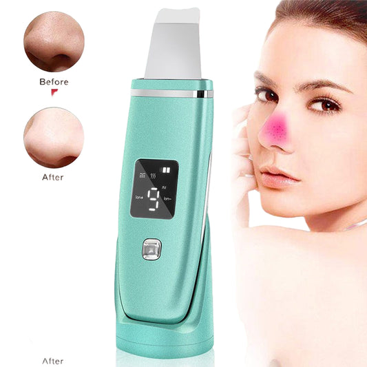 Machine a exfolier la peauWENDY BEAUTY